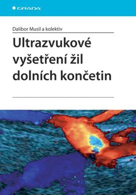 E-kniha: Ultrazvukové vyšetření žil dolních končetin od kolektiv