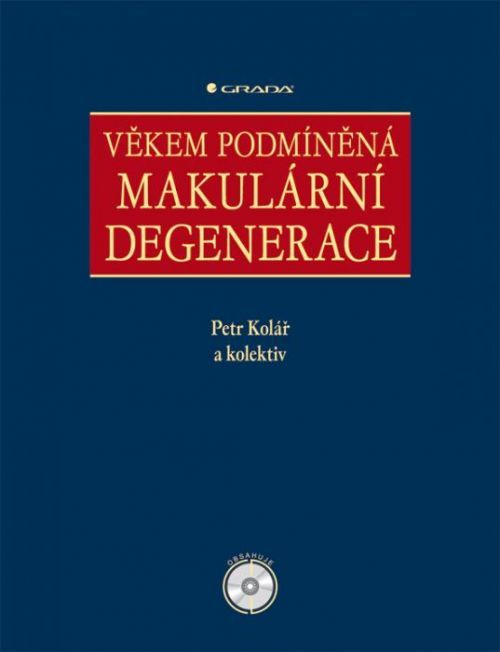 E-kniha: Věkem podmíněná makulární degenerace od Kolář Petr