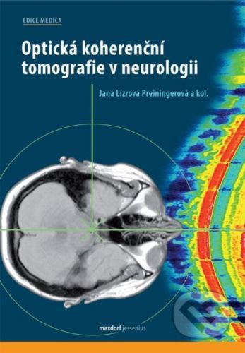 Optická koherenční tomografie v neurologii - Jana Preiningerová Lízrová