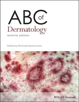 ABC of Dermatology(Paperback / softback)