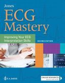 ECG Mastery - Improving Your ECG Interpretation Skills (Jones Shirley A.)(Paperback / softback)