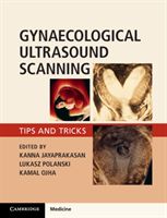 Gynaecological Ultrasound Scanning - Tips and Tricks (Jayaprakasan Kanna)(Paperback / softback)