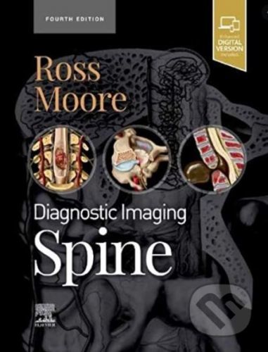 Diagnostic Imaging: Spine - Kevin R. Moore, Jeffrey S. Ross