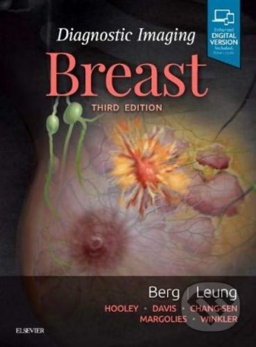 Diagnostic Imaging: Breast - Wendie A. Berg, Jessica Leung