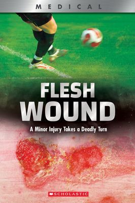 Flesh Wound (XBooks) - A Minor Injury Takes a Deadly Turn (Phillips Shea)(Paperback)