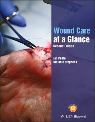 Wound Care at a Glance (Peate Ian)(Paperback / softback)