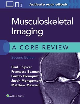 Musculoskeletal Imaging: A Core Review (Spicer Paul)(Paperback / softback)