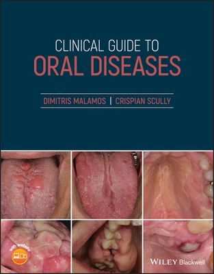 Clinical Guide to Oral Diseases (Malamos Dimitris)(Paperback / softback)