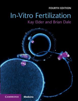 In-Vitro Fertilization (Elder Kay (Bourn Hall Clinic Cambridge))(Paperback / softback)