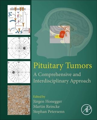 Pituitary Tumors - A Comprehensive and Interdisciplinary Approach(Pevná vazba)