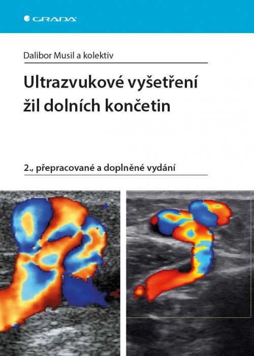 Ultrazvukové vyšetření žil dolních končetin, Musil Dalibor