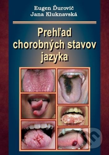 Prehľad chorobných stavov jazyka - Eugen Ďurovič