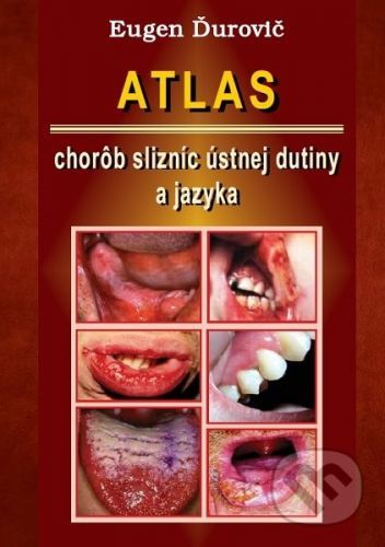 Atlas chorôb slizníc ústnej dutiny a jazyka - Eugen Ďurovič