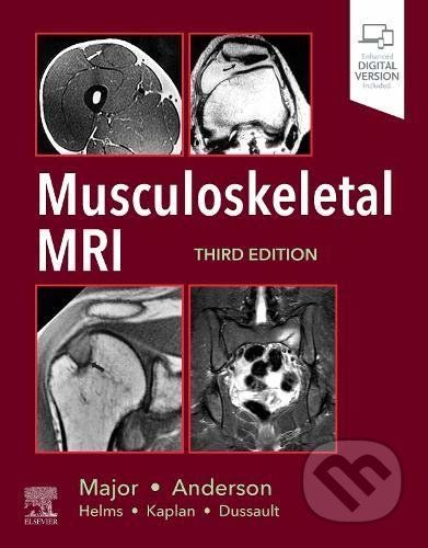 Musculoskeletal MRI - Nancy M. Major, Mark W. Anderson