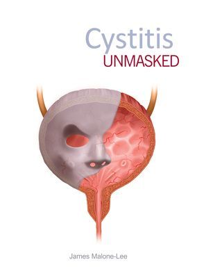 Cystitis Unmasked (Malone-Lee James)(Paperback)