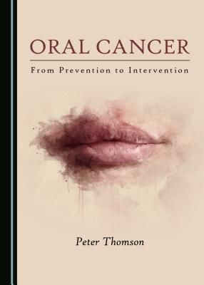 Oral Cancer - From Prevention to Intervention (Thomson Peter)(Pevná vazba)